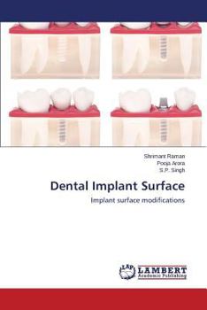 Paperback Dental Implant Surface Book