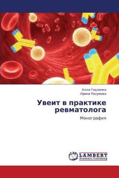 Paperback Uveit V Praktike Revmatologa [Russian] Book