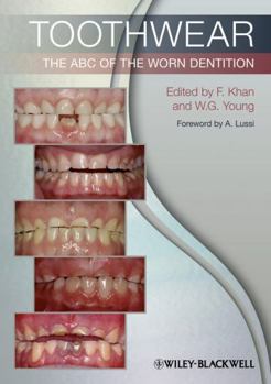 Paperback Toothwear: The ABC of the Worn Dentition Book