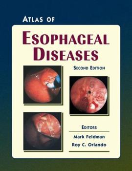 Hardcover Atlas of Esophageal Diseases Book