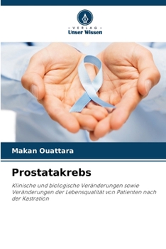 Paperback Prostatakrebs [German] Book