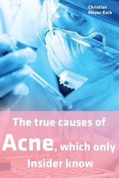 Paperback The true causes of Acne, which only Insider know Book