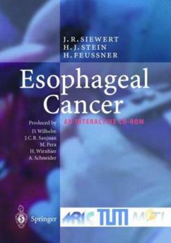 Audio CD Esophageal Cancer: An Interactive CD-ROM Book