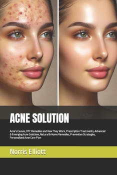 Acne Solution: Acne's Causes, OTC Remedies and How They Work, Prescription Treatments, Advanced & Emerging Acne Solutions, Natural &