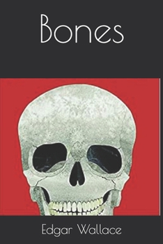 Bones