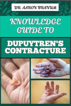 KNOWLEDGE GUIDE TO DUPUYTREN’S CONTRACTURE: Comprehensive Manual To Symptoms, Treatments, And Preventative Care For Hand Health And Mobility