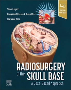 Paperback Radiosurgery of the Skull Base: A Case-Based Approach Book