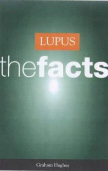 Paperback Lupus: The Facts Book