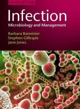 Paperback Infection: Microbiology and Management Book