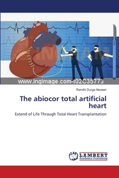 Paperback The abiocor total artificial heart Book