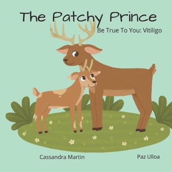 Paperback The Patchy Prince: Be True To You: Vitiligo Book
