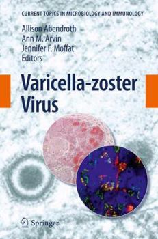 Paperback Varicella-Zoster Virus Book