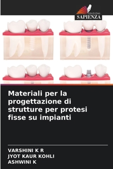 Paperback Materiali per la progettazione di strutture per protesi fisse su impianti [Italian] Book