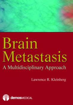 Hardcover Brain Metastasis: A Multidisciplinary Approach Book