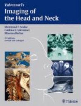 Imaging of the Head and Neck