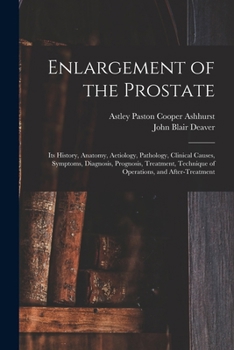 Paperback Enlargement of the Prostate: Its History, Anatomy, Aetiology, Pathology, Clinical Causes, Symptoms, Diagnosis, Prognosis, Treatment, Technique of O Book