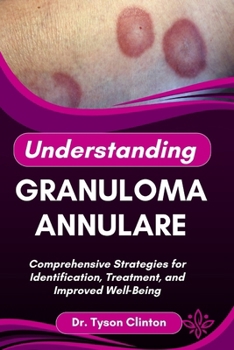 Paperback Understanding Granuloma Annulare: Comprehensive Strategies for Identification, Treatment, and Improved Well Being Book