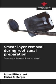 Paperback Smear layer removal during root canal preparation Book