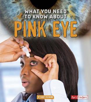 Paperback What You Need to Know about Pink Eye Book