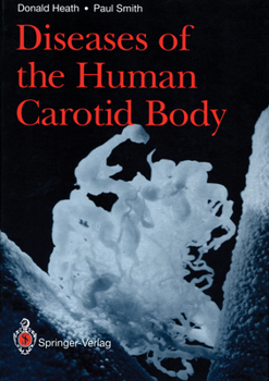 Paperback Diseases of the Human Carotid Body Book