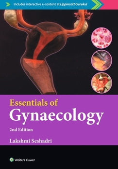 Paperback Essentials of Gynaecology, 2/e Book