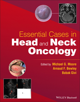 Paperback Essential Cases in Head and Neck Oncology Book