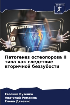 Paperback Патогенез остеопороза II m [Russian] Book
