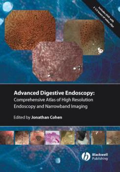 Hardcover Comprenhensive Atlas of High Resolution Endoscopy and Narrowband Imaging [With DVD-ROM] Book