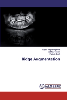 Paperback Ridge Augmentation Book