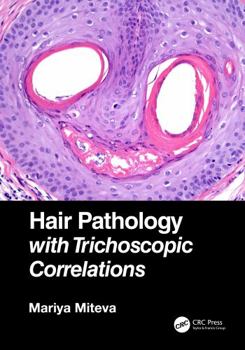 Hardcover Hair Pathology with Trichoscopic Correlations Book