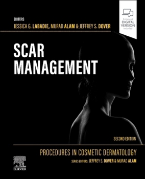 Hardcover Procedures in Cosmetic Dermatology: Scar Management Book