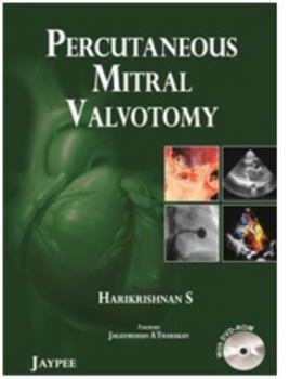 Paperback Percutaneous Mitral Valvotomy Book