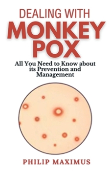 Paperback Dealing with MonkeyPox: All You Need to Know about its Prevention and Management Book