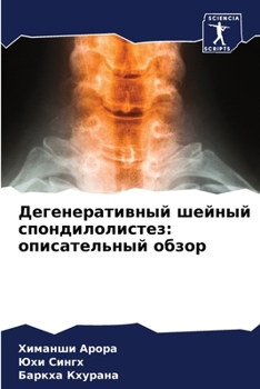 Paperback Дегенеративный шейный с& [Russian] Book