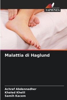 Paperback Malattia di Haglund [Italian] Book