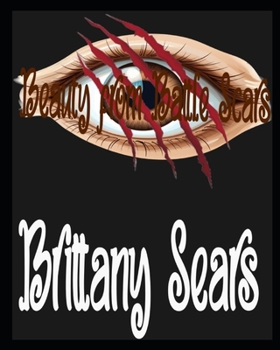 Paperback Beauty from Battle Scars Book