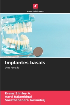 Paperback Implantes basais [Portuguese] Book