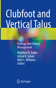 Hardcover Clubfoot and Vertical Talus: Etiology and Clinical Management Book