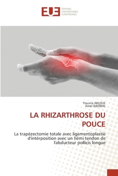 La Rhizarthrose Du Pouce (French Edition)