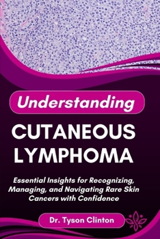 Paperback Understanding Cutaneous Lymphoma: Essential Insights for Recognizing, Managing, and Navigating Rare Skin Cancers with Confidence Book