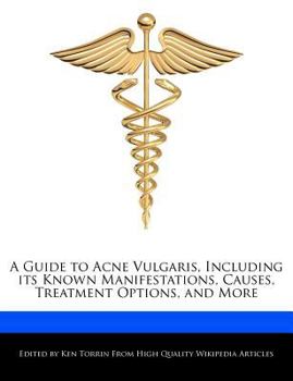 Paperback A Guide to Acne Vulgaris, Including Its Known Manifestations, Causes, Treatment Options, and More Book