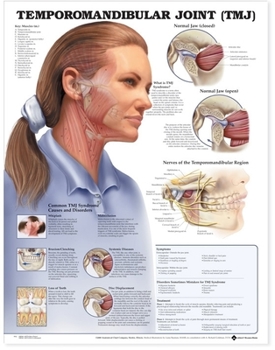 Wall Chart Temporomandibular Joint (Tmj) Anatomical Chart Book