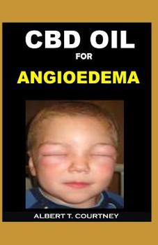 Paperback CBD Oil for Angioedema: The Simple Guide on How CBD Oil Works for Angioedema Book