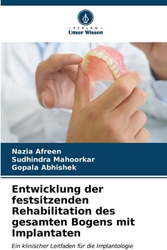 Paperback Entwicklung der festsitzenden Rehabilitation des gesamten Bogens mit Implantaten [German] Book