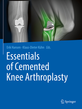 Paperback Essentials of Cemented Knee Arthroplasty Book