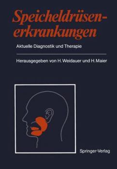 Paperback Speicheldrüsenerkrankungen: Aktuelle Diagnostik Und Therapie [German] Book