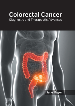 Hardcover Colorectal Cancer: Diagnostic and Therapeutic Advances Book