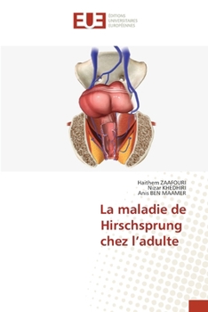 La maladie de Hirschsprung chez l'adulte