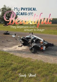 Hardcover My Physical Scars Are Beautiful: They Represent God's Answer to Prayer Book