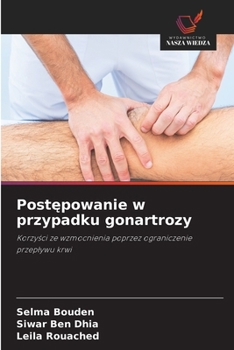 Postepowanie w przypadku gonartrozy (Polish Edition)